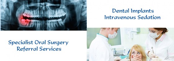 Dental Implants Intravenous Sedation: Ochilview Dental